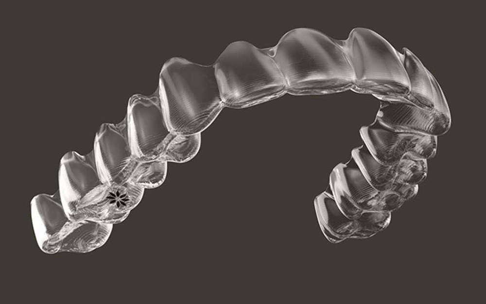 Aligneurs Invisalign transparents pour patients de Oka