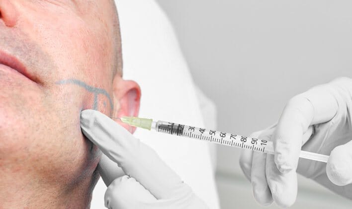 Injection de Botox thérapeutique au masséter