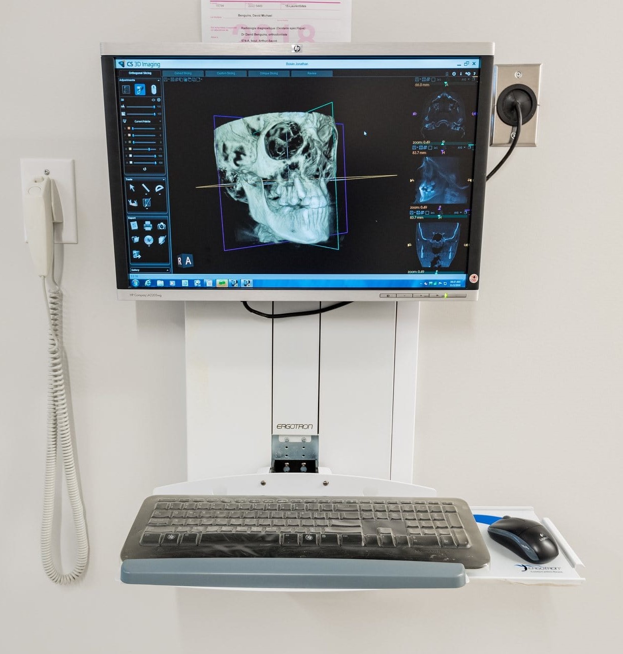 Scanner 3D CBCT