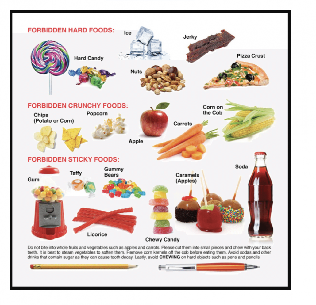 Chart of foods to avoid during orthodontic treatment - hard, crunchy, sticky