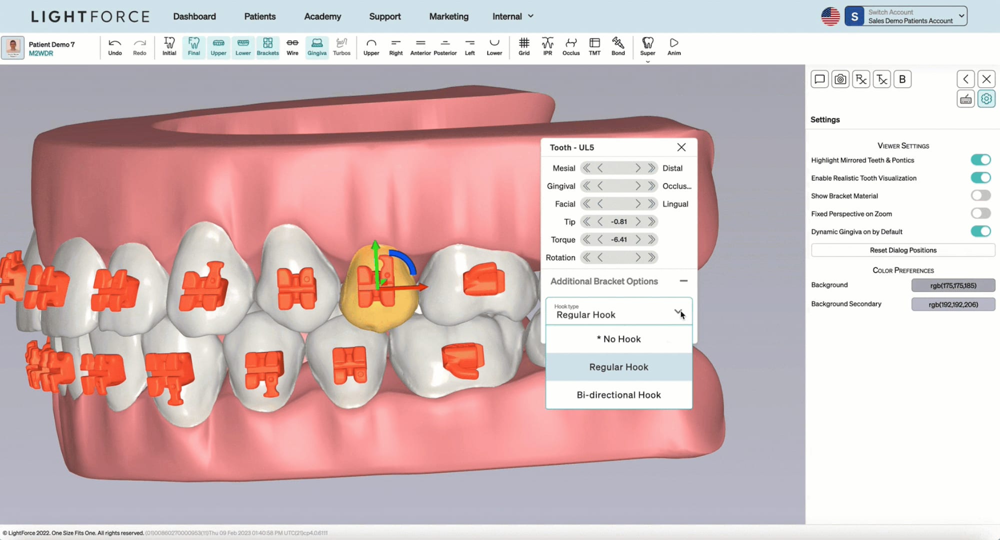 Interface LightPlan pour la planification 3D du treatment orthodontic