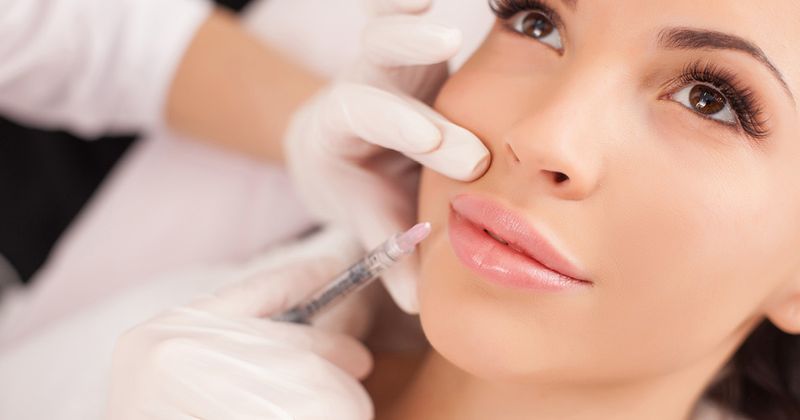 Perioral region dermal filler injection