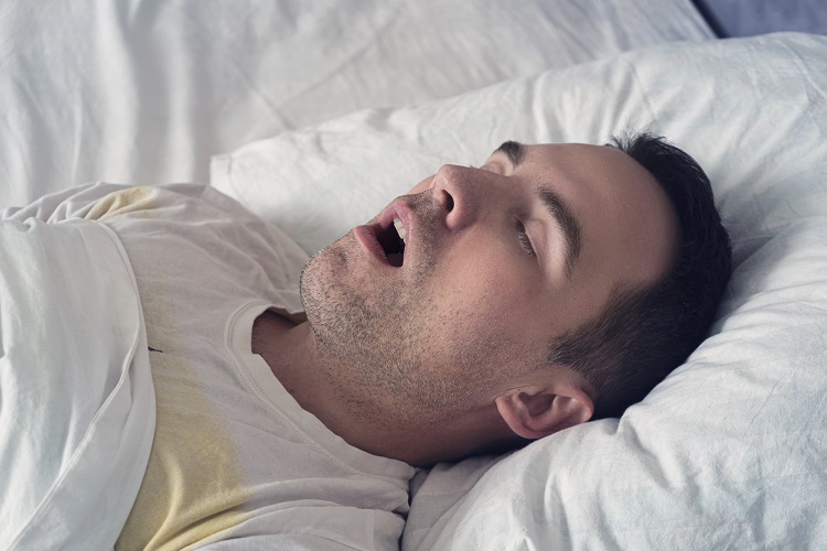 Sleep apnea - snoring