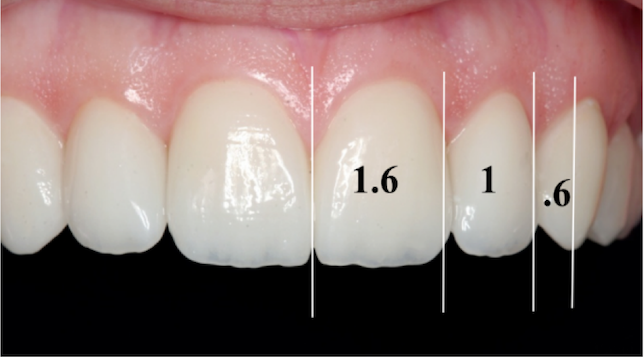 Micro-aesthetics - ideal dental proportions