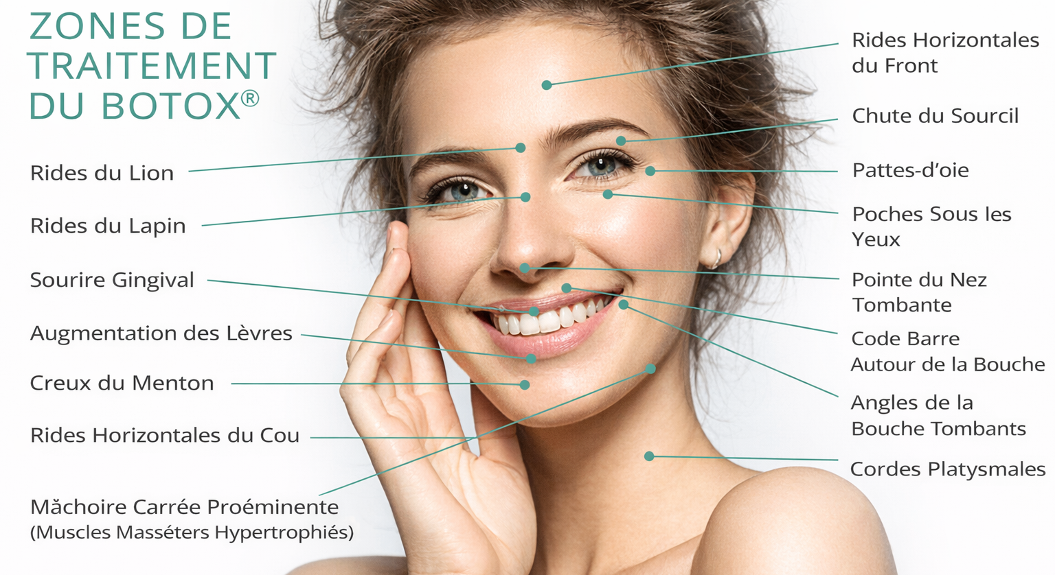 Zones de traitement du Botox - rides du front, pattes d'oie, ride du lion, sourire gingival, augmentation des l&egrave;vres, m&acirc;choire, cou